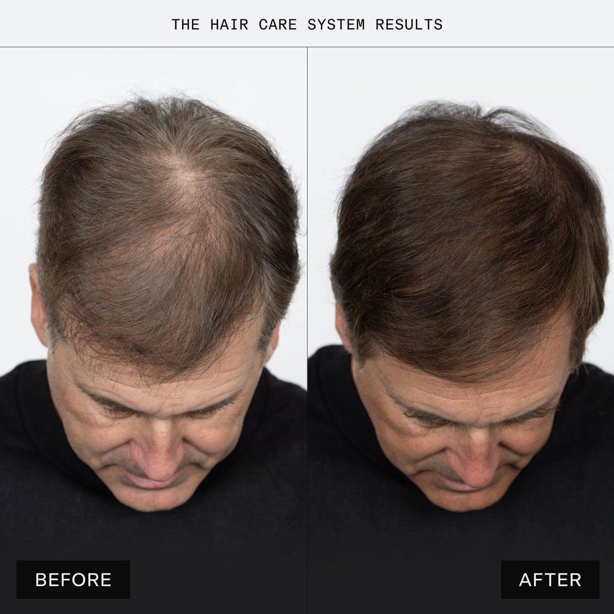 Caldera + Lab The Hair Serum